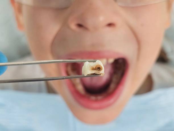 Best Emergency Treatment for Toothache in Bay, AR